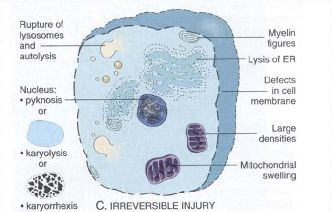 Necrosis - features Nuclear changes Irreversible cell swelling, disintegration Irreversible cell injury = cell death =necrosis Detected by changes in the cell nuclei Pyknosis nuclear