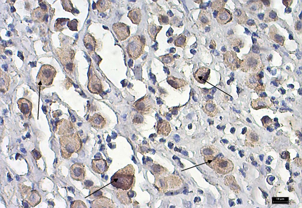 Fig. 2. Microscopic view of canine mastocytoma.