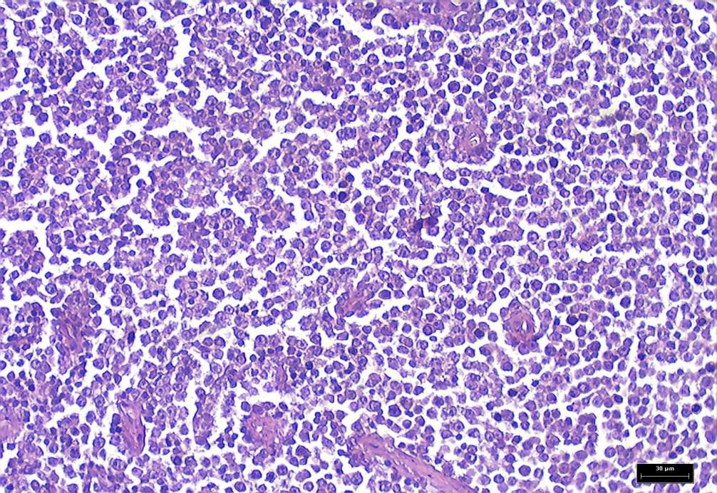 Fig. 8. Transmissible venereal tumour. H/E staining. REFERENCES 1. Brodey, R., 1970. Canine and feline neoplasia. Adv Vet Sci Comp Med, 14, 309-354. 2. Finnie, J., D. Bostock, 1979.