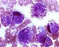 Introduction Mast cells Resident inflammatory cell of the skin, lungs, gastro- intestinal tract Reactions
