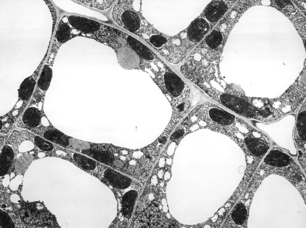 2 Fig. 2.1 is an electron micrograph showing palisade mesophyll cells. 6 X Y magnification x 3500 Fig. 2.1 (a) Calculate the actual length of the palisade mesophyll cell shown between X and Y.
