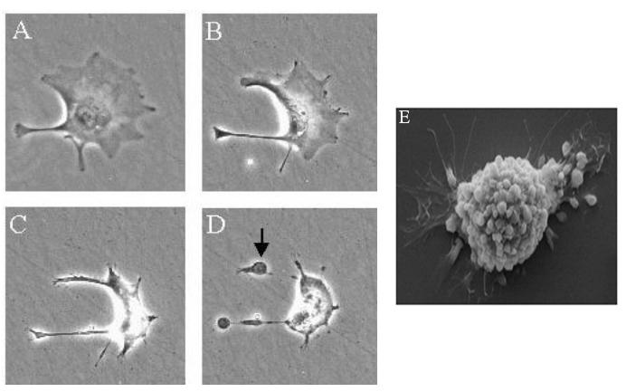 Slika 6. Elektromikrografski prikaz procesa apoptoze ćelije.