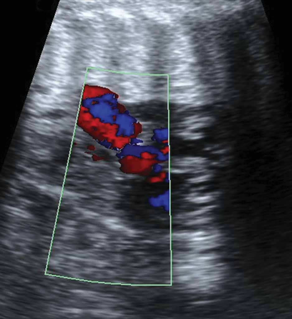 small number of anomalies and misdiagnosed cases and incomplete follow-up data for some cases with detected fetal cardiac anomalies during our study period because we are a referral center.