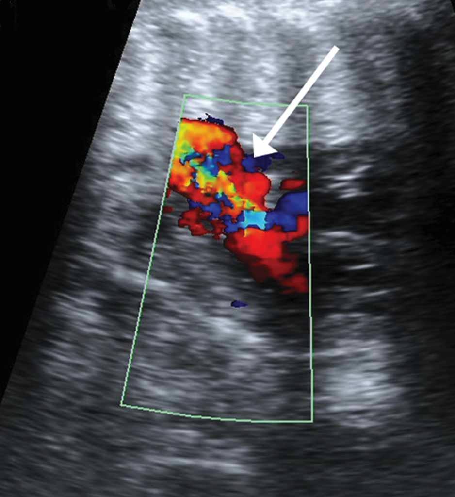 Guidelines adopted by the American Institute of Ultrasound in Medicine, American College of Obstetricians and Gynecologists, and American College of Radiology recommend obtaining the 4-chamber view