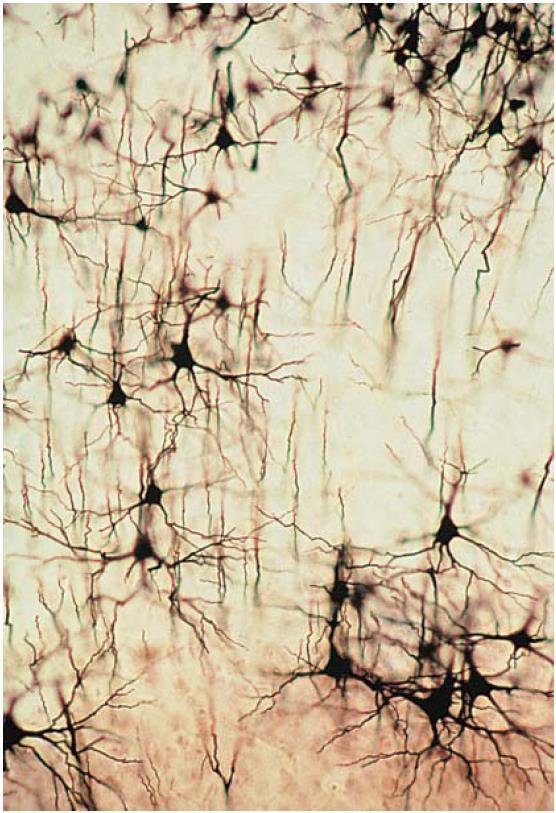 Visualizing Neurons 1 The major problem in visualizing neurons is not their minuteness; rather, it is the fact that neurons are so tightly packed and their dendrites and axons intricately intertwined.