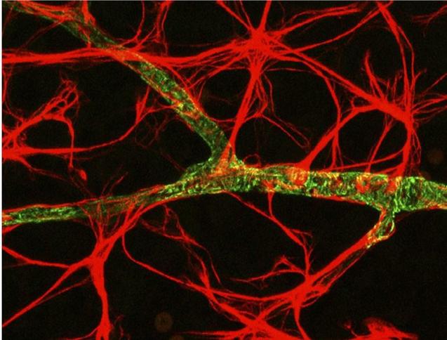 CNS Glia - Astrocytes some processes terminate as endfeet on capillaries, nodes of Ranvier, and synapses - regulate the environment Functions: Remove excess K + Induce formation of + synapses