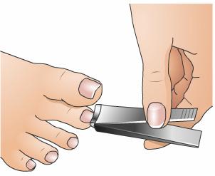 Regular Foot Care Keep toenails neatly trimmed. After a bath or shower, cut the toenails with the shape of your toes so they are even with the skin on the end of your toes.
