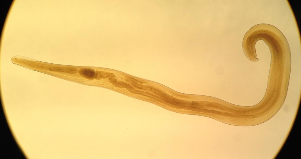 Five Most Common Parasites A study published in the American Family Physician journal reports that E. vermicularis is the most prevalent nematode in the U.S.