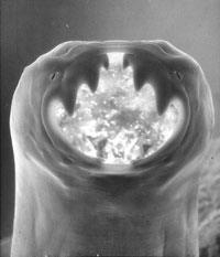 Five Most Common Parasites Hookworm is another common parasite that affects humans.