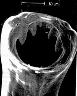 The hookworm attaches itself to the intestinal walls and feeds on human blood.