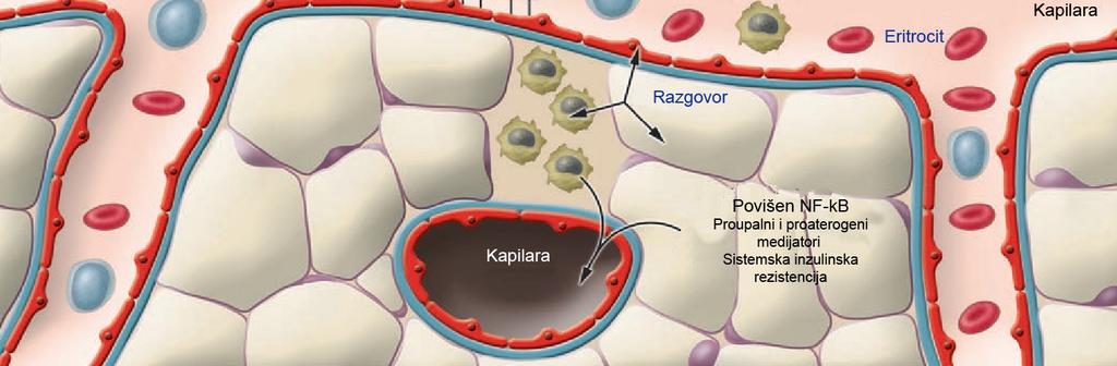 I adipociti bogati mašću i regrutirani makrofazi sudjeluju u patogenezi upalom inducirane inzulinske rezistencije (Slika 3).