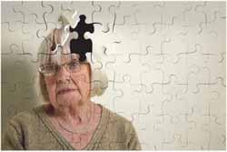 psychotherapy (CBT, IPT) Group psychotherapy Family Therapy Memory Problems in Elderly