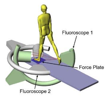 Fluoroscopy systems Li G, et al.
