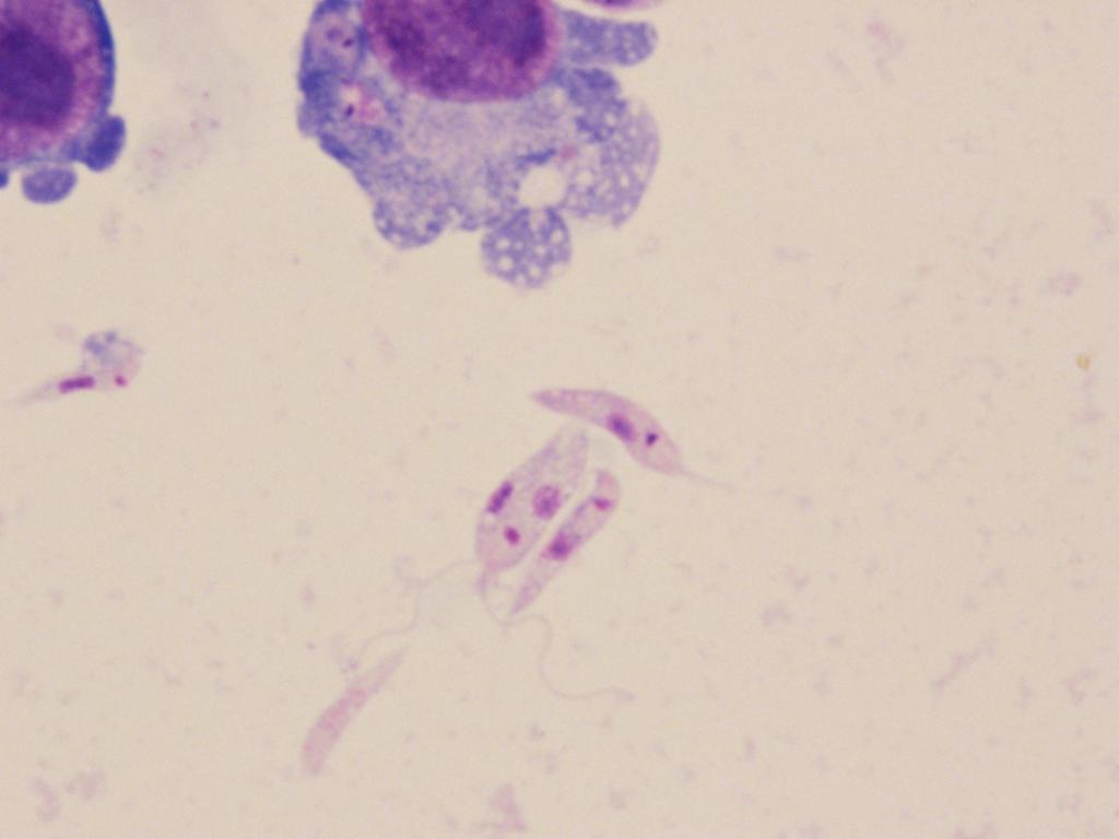 is an intracellular protozoan parasites transmitted to humans through the bite of infected sand flies. Promastigotes with typical large nucleus and kinetoplast in the anterior end were observed.