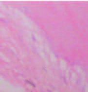 () In the interfces of tendons nd llogeneic trnsplnted bones, fibroblsts ctively proliferted with formtion of visible collgen fibers; osteoblsts ctively proliferted without obvious new bonelike