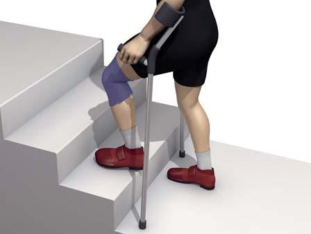 Postoperative Treatment Rehabilitation The operated leg is immobilized in a splint and the knee joint is cooled. Isometric contraction exercises should be performed on the fi rst postoperative day.