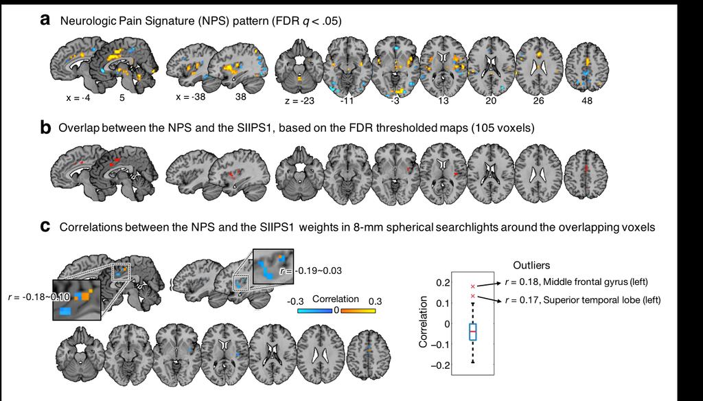 QUANTIFYING CEREBRAL CONTRIBUTIONS TO PAIN 3 Supplementary Figure 3. Spatial pattern similarity between the SIIPS1 and the NPS 1.