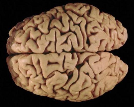 The Cerebrum Involved with higher brain functions. Processes sensory information. Initiates motor functions. Integrates information.
