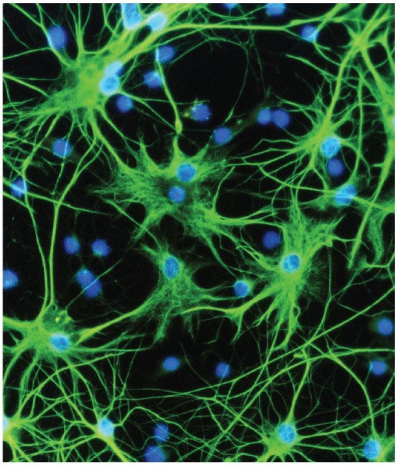 impulses. Neuroglia: supporting cells.