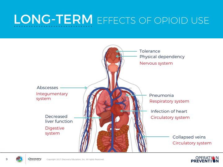 EXPLAIN SLIDE 9 Now that students have examined the short-term effects, they will examine the long-term effects of opioid misuse on the body.