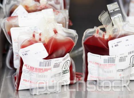 LCS SIGMA TM Blood Transfusion 58 U 54U 16U Haemoglobin Value 8.9 8.6 10.