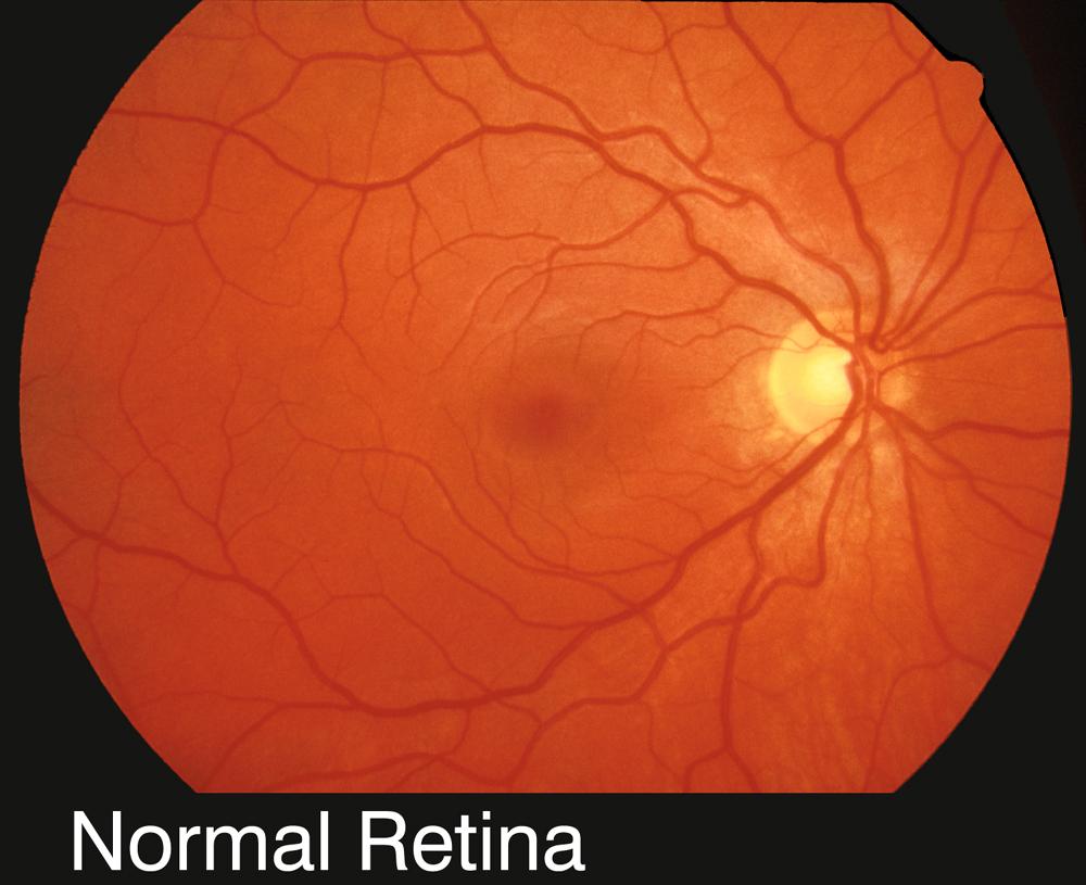 Structure and function of the eye retinal