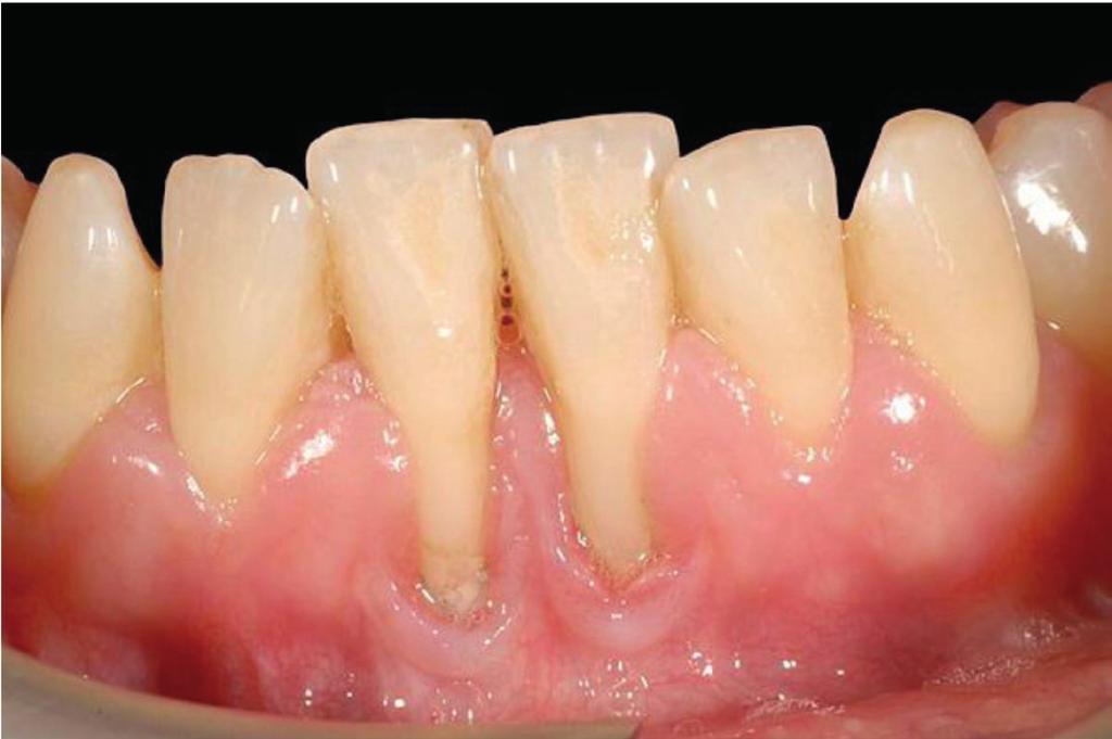 periodontal treatment.