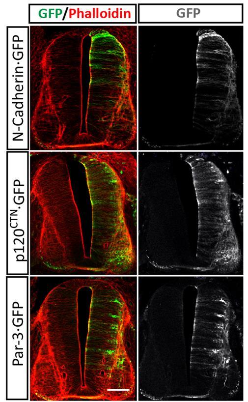 Supplementary Figure 7. Overexpression of N-Cadherin, p120 CTN or Par3 do not cause epithelial aberrations.