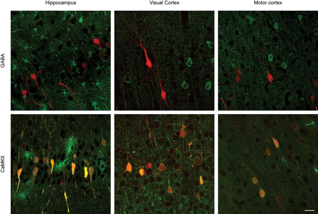 Supplementary Fig. S6: in specific transfection of excitatory neurons. In utero electroporation of hippocampus and visual or motor cortex results Supplementary Fig.