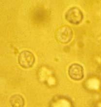 Animals Cryptosporidium can produce patent infections in cats and dogs with no accompanying clinical signs.
