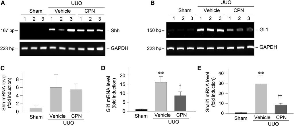 staining revealed a dose-dependent inhibition of the Shh-induced type I collagen and a-sma protein expression by CPN in NRK-49F cells (Figure 5H).