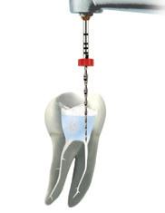 Check that the RECIPROC motor setting has been selected. 4. Introduce the RECIPROC instrument into the canal. Press the motor foot pedal when the instrument is at the root canal orifice. 3x 5.