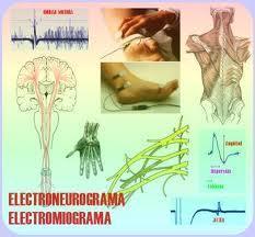 Electroneurogram An electroneurogram is a method used to visualize directly recorded electrical activity of neurons in the central nervous system (brain, spinal cord) or the peripheral nervous system