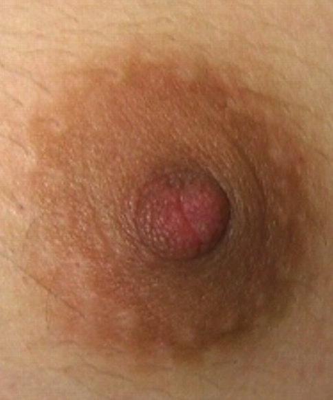 Nipples are devoid of Raised structures on the