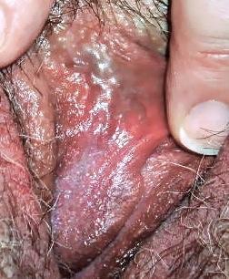 Clitoral body ( shaft ) connected to