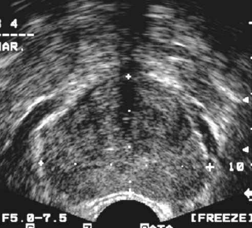 Description of Ultrasound Images