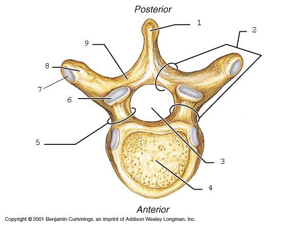 Thoracic Vertebrae 1. Spinous Process 3. Foramen 4. Vertebral Body 5. Pedicle 6.