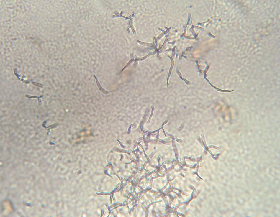 Identification of the Selected Isolate: Micromorphology: The aerial mycelium developed moderately on most of the media. The aerial hyphae were short and extensively branched.