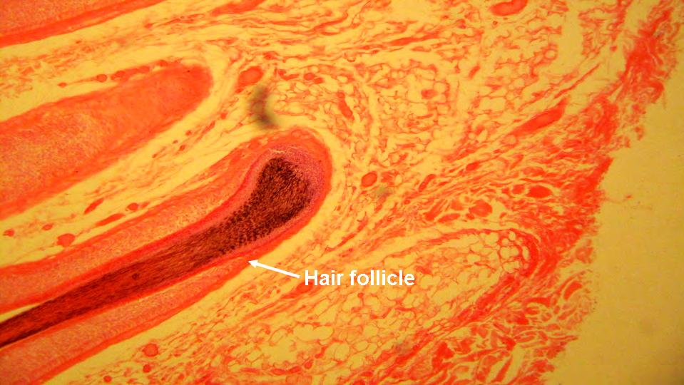 Figure 9: Human skin (A) 1000x. The layers of the epidermis can be distinguished.