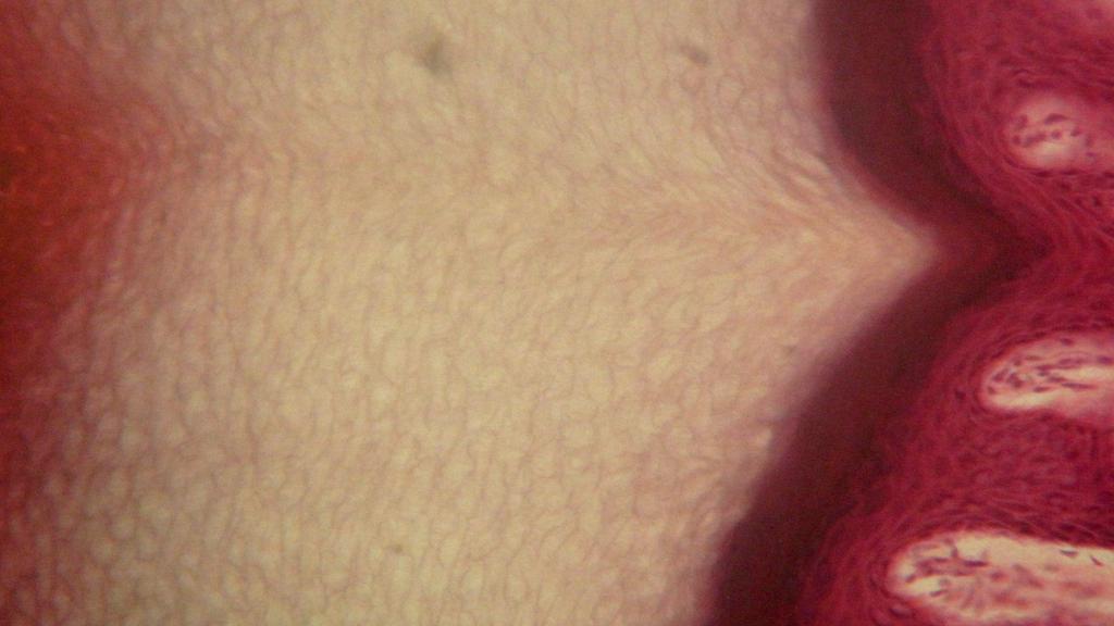 Figure 10: Human skin (B) 1000x. Enlargement of a hair follicle located in the dermis.
