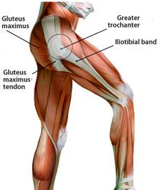External Snapping Hip Gluteus maximus tendon or