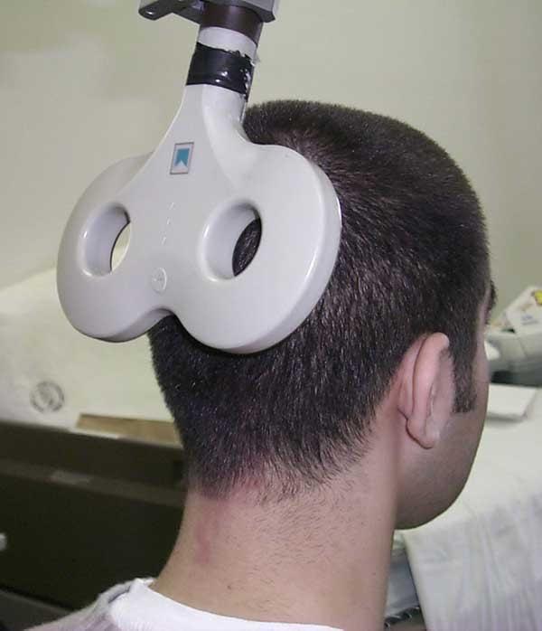 Repetitive transcranial magnetic stimulation. Newer technique.