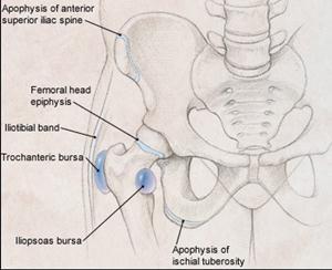Causes of Hip Pain Bursitis Trochanteric: IT band causing friction with moving from