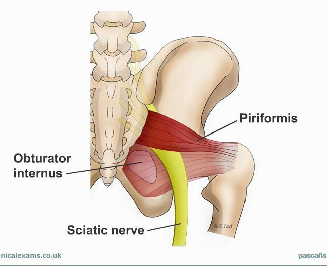 Causes of Hip Pain Piriformis
