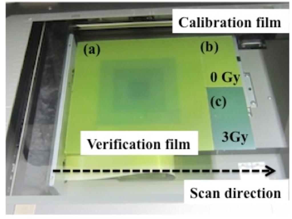 415 Shimohigashi et al.: Evaluation of a single-scan protocol 415 verification dose range (~ 2 Gy). A single calibration film is required for all verification film.