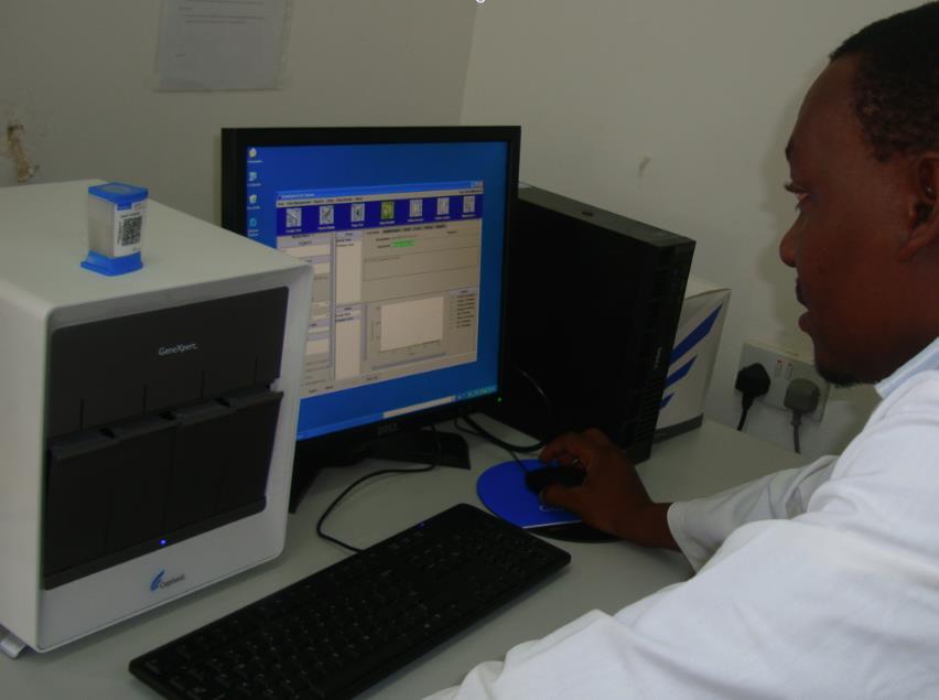 TB Studies Ifakara Lab has acquired New GeneXpert System through Swiss TPH Improve TB diagnosis and care for HIV patients within
