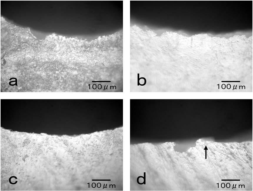 12 K. NISHIMURA et al. J Med Dent Sci Fig. 2. Light microscopic images of the marginal enamel (x200). a: Prepared with regular-grit diamond bur (group 1).