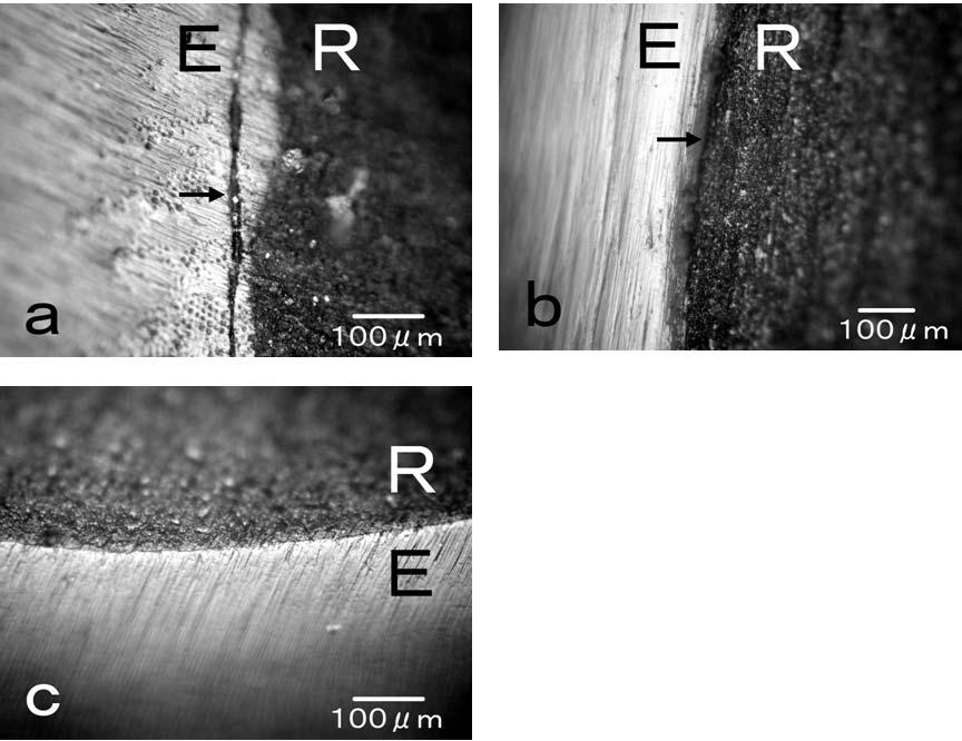 EFFECT OF VARIOUS GRIT BURS ON MARGINAL INTEGRITY 13 Fig. 3. Light microscopic images at the surface of the cavosurface margin of restoration (x200).