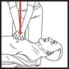 Chest compressions-30 If the victim is still not breathing normally, coughing or moving, begin chest compressions.