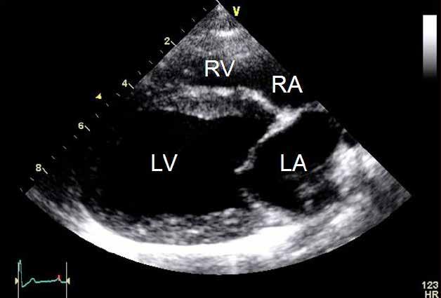 Cardiac ultrasound protocols IDEXX Telemedicine Consultants Two-dimensional and M-mode imaging planes Right parasternal long axis four chamber Obtained from the right side Displays the relative
